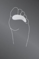 Опорно-корригирующая подкладка protect.Toe cushion