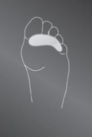 Опорно-корригирующая подкладка protect.Toe cushion
