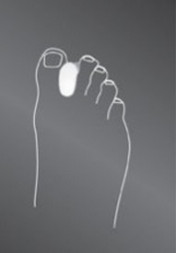 Межпальцевый корректор protect.Toe spreader