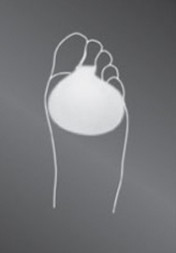 Подкладка для переднего отдела стопы protect.Forefoot cushion