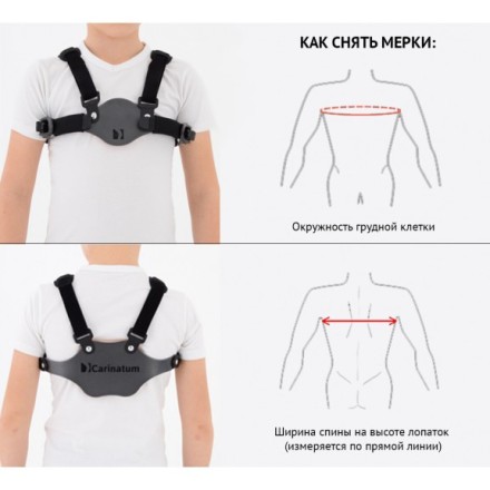Детский ортез на клиновидную грудь Reh4Mat Carinatum AM-TX-04