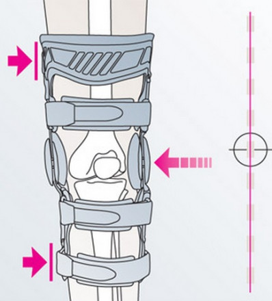 Регулируемый жесткий коленный ортез medi M.4s OA, G027, G028